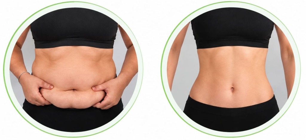 PMOS Weight Reset Before and After Transformation